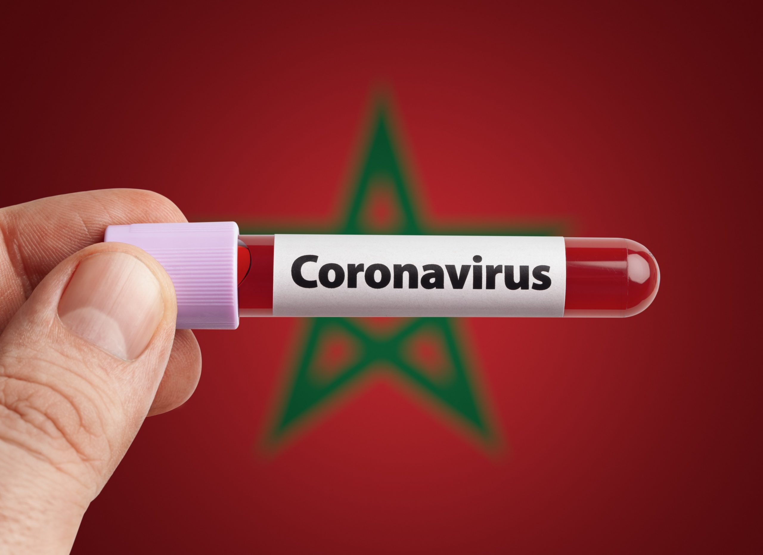 Coronavirus