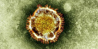 coronavirus Maroc 2014 04 25