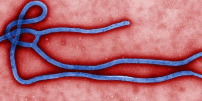 virus Ebola 2014 07 31