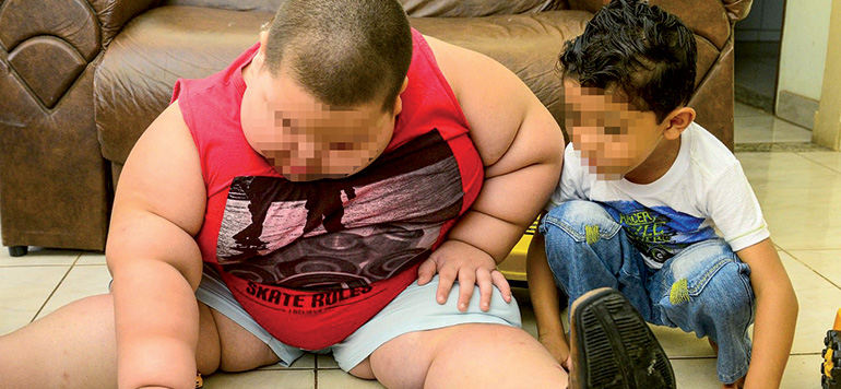 syndrome de Prader wili