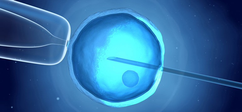 procreation medicalement assistee