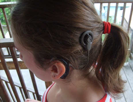 Cochlear implant2