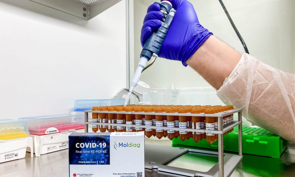 Tests Covid